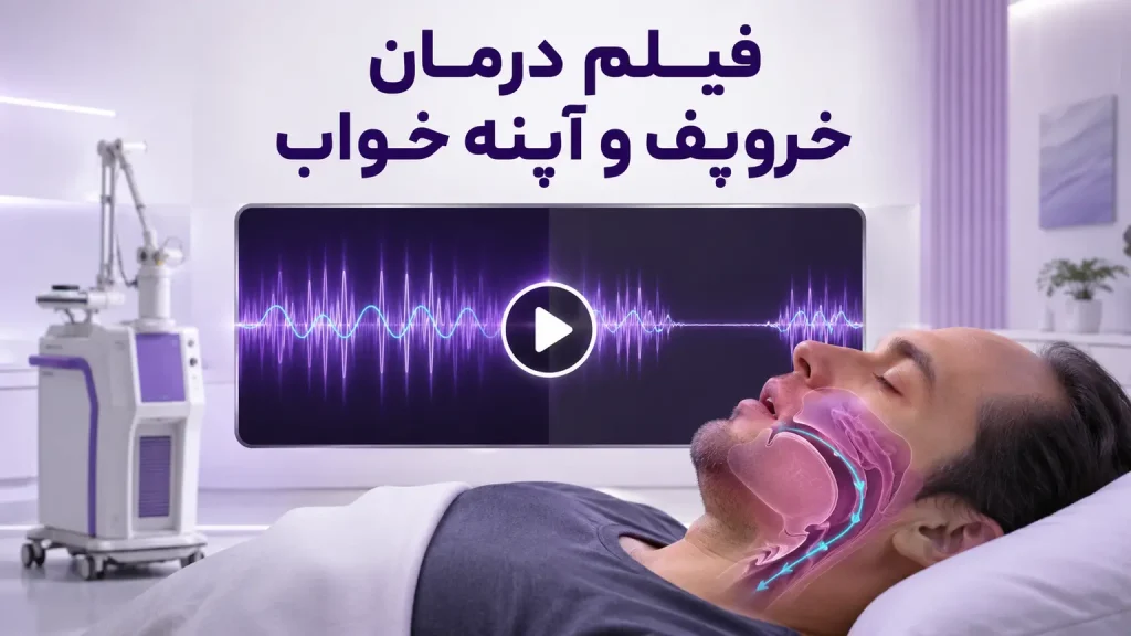 فیلم درمان خروپف و آپنه خواب؛ نمای راه هوایی و دستگاه لیزر فوتونا